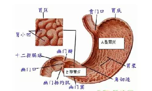 根除幽门螺旋杆菌2016最新方案论述