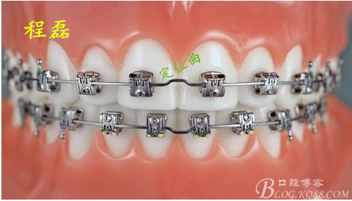 纯钛牙套价格，深度解析与科普