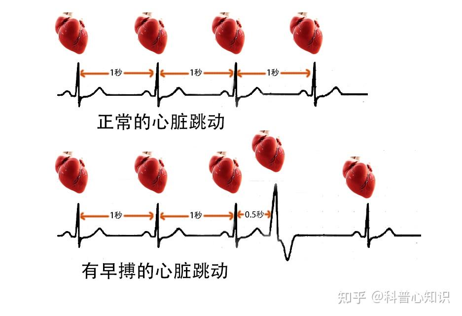 最新早搏吧，带你领略心跳的节奏！